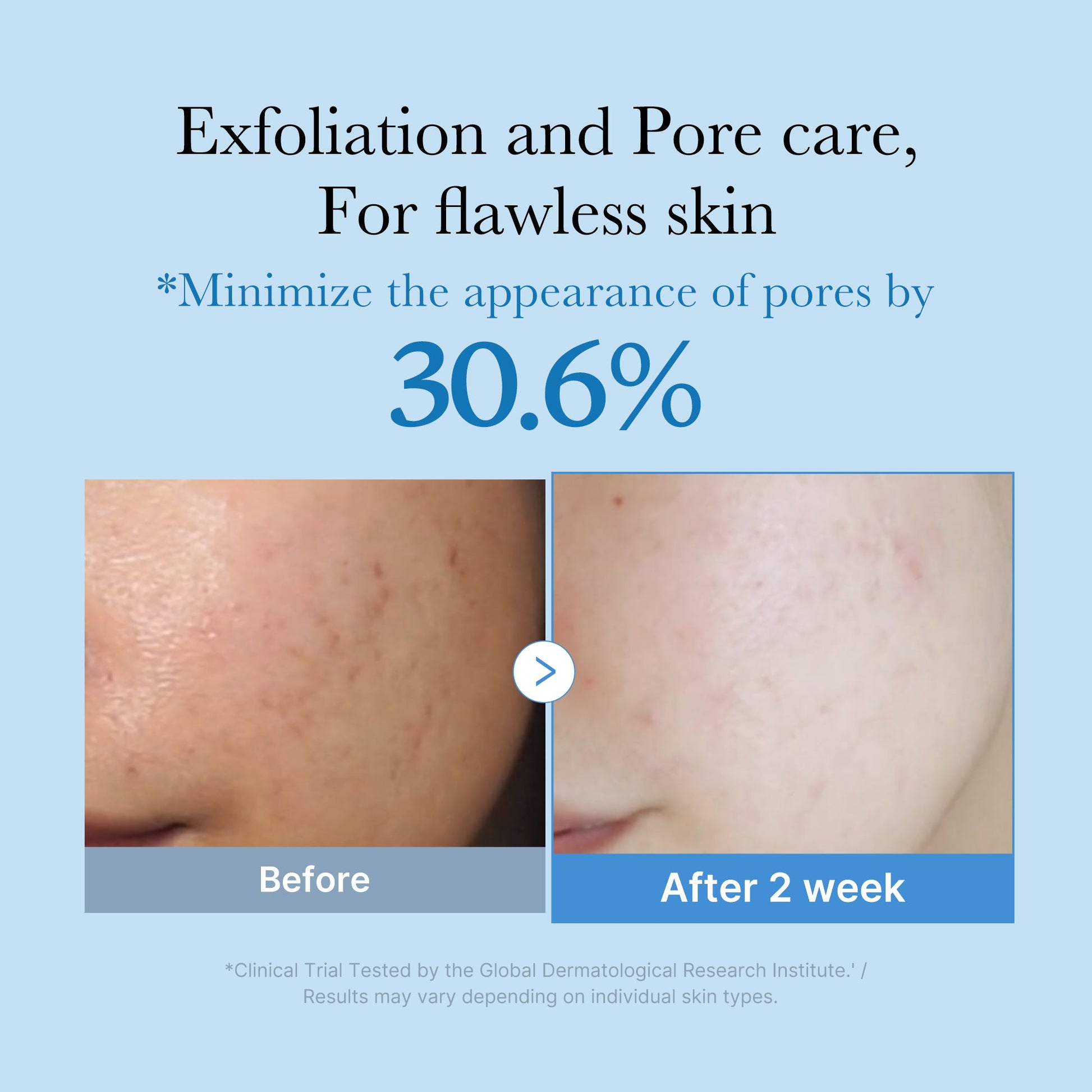 zero-pore-toner-p6 01_d6480b4e-3c08-4954-994a-ed5212c1839c.jpg