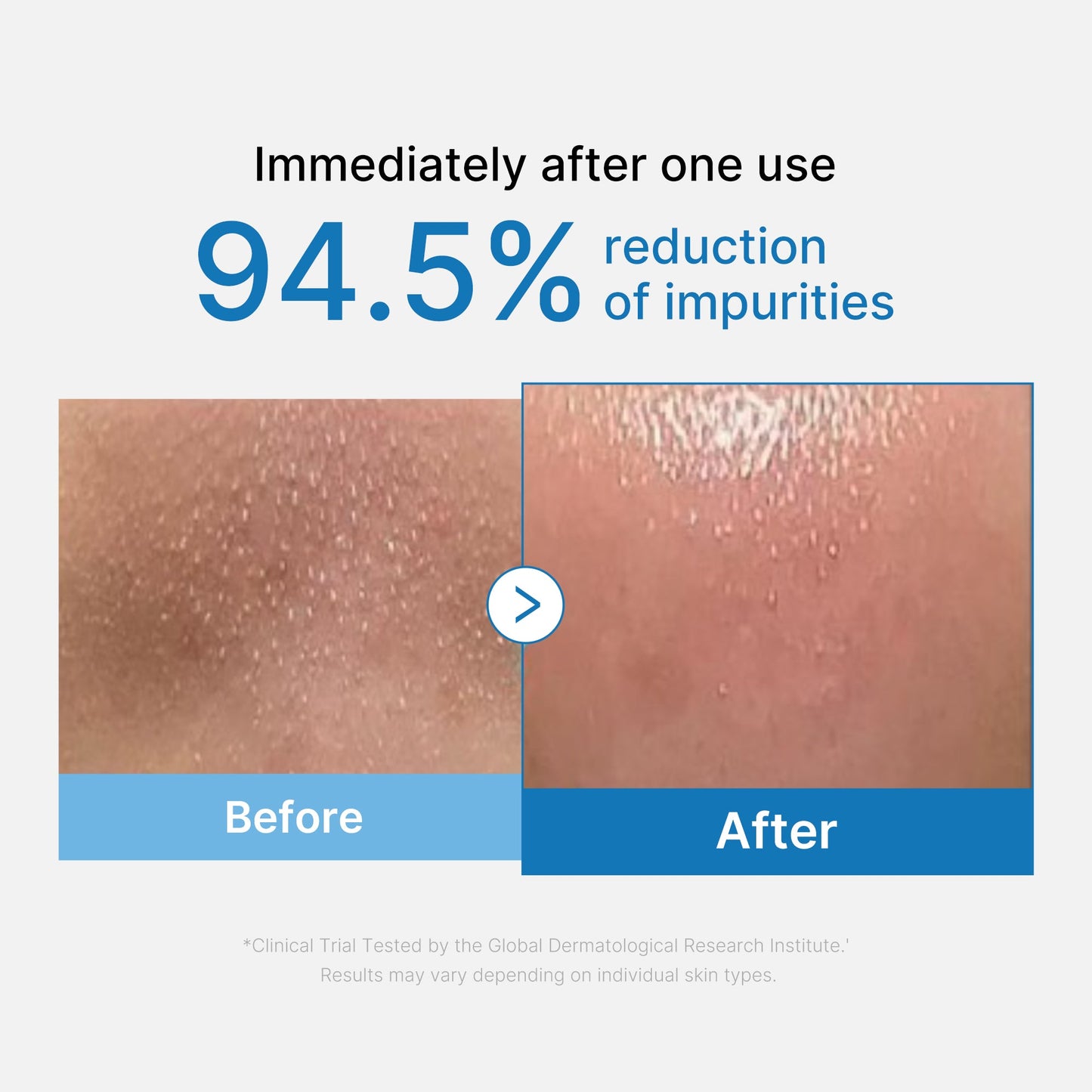 zero-pore-blackhead-deep-cleansing-oil-r9 01_eed557ec-5857-46a2-8b17-dbd67c692dcb.jpg