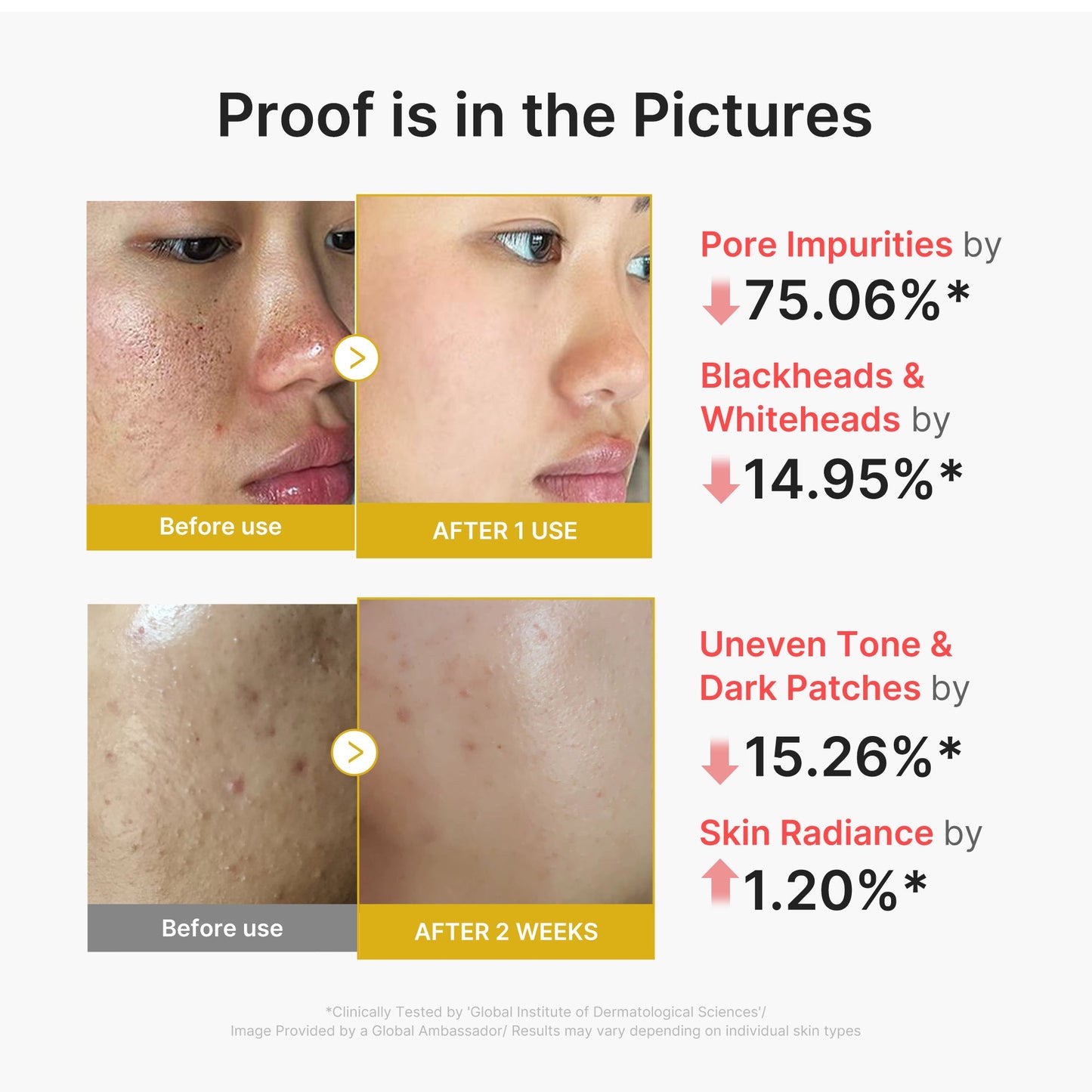 kojic-acid-turmeric-peel-shot-w5 02_45fe66d3-b3f6-4100-aa52-2afd7eded417.jpg