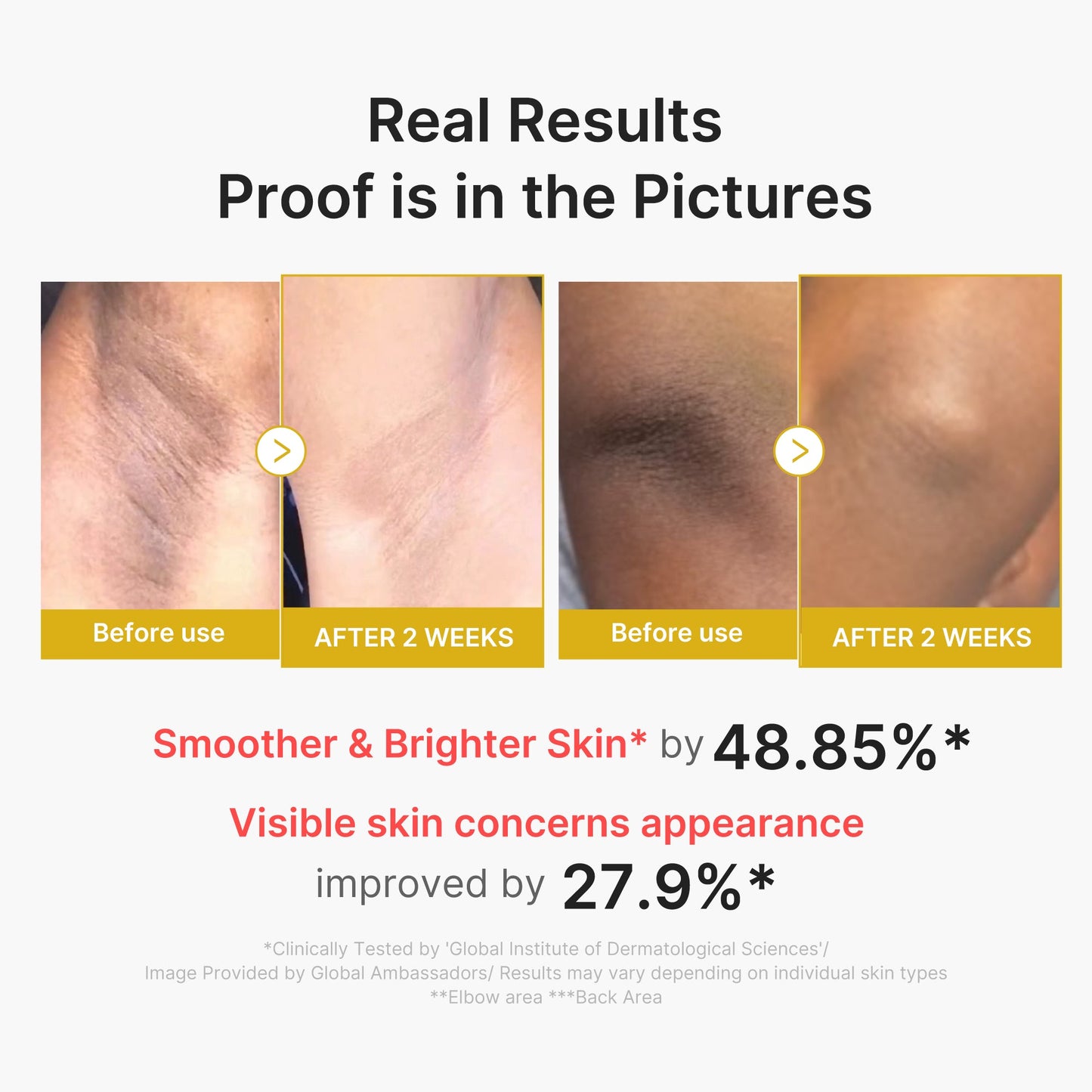 kojic-acid-turmeric-body-peel-shot-d8 02_72880cfc-382b-440b-8152-7e3dce87da2a.jpg