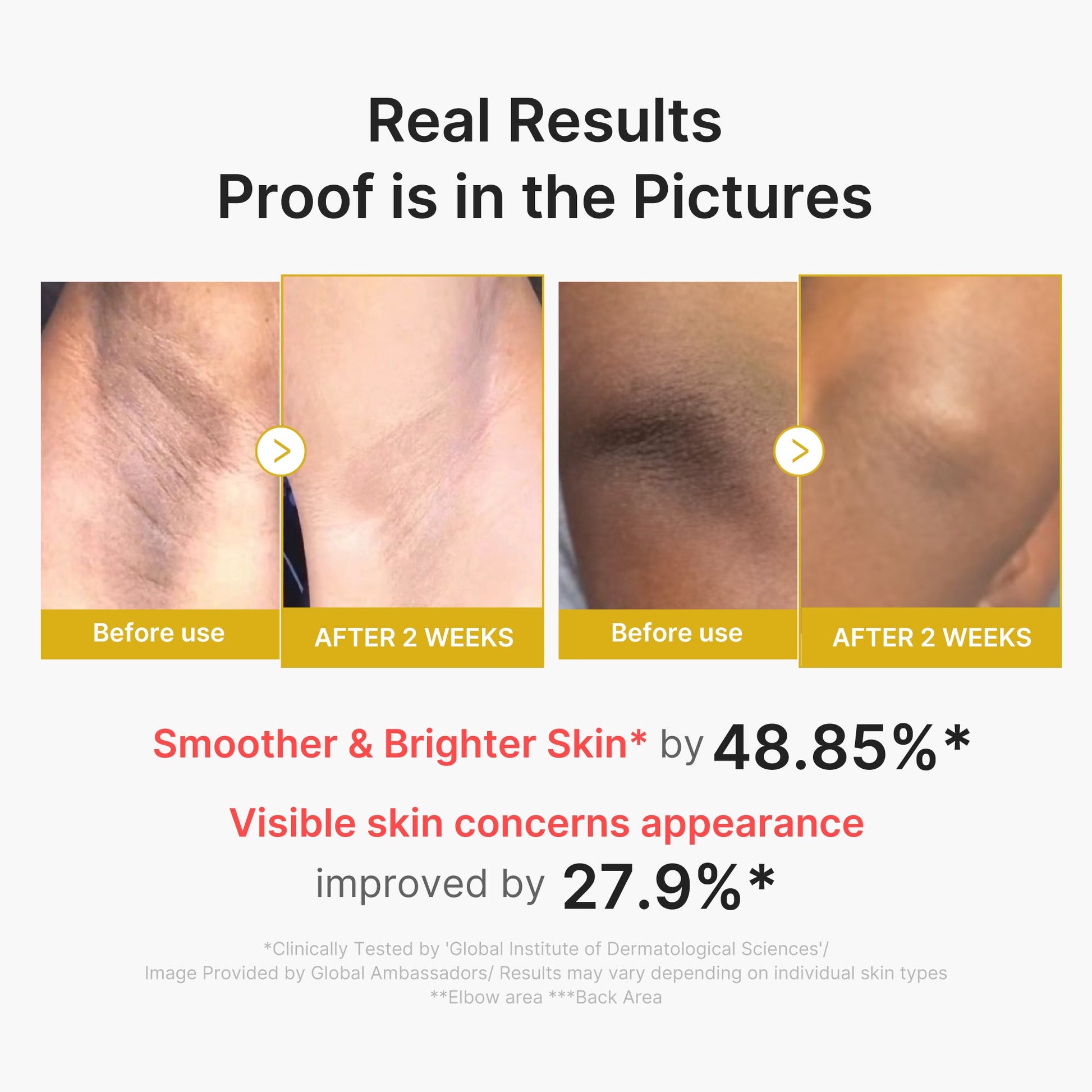 kojic-acid-turmeric-body-peel-shot-a4 02_72880cfc-382b-440b-8152-7e3dce87da2a.jpg