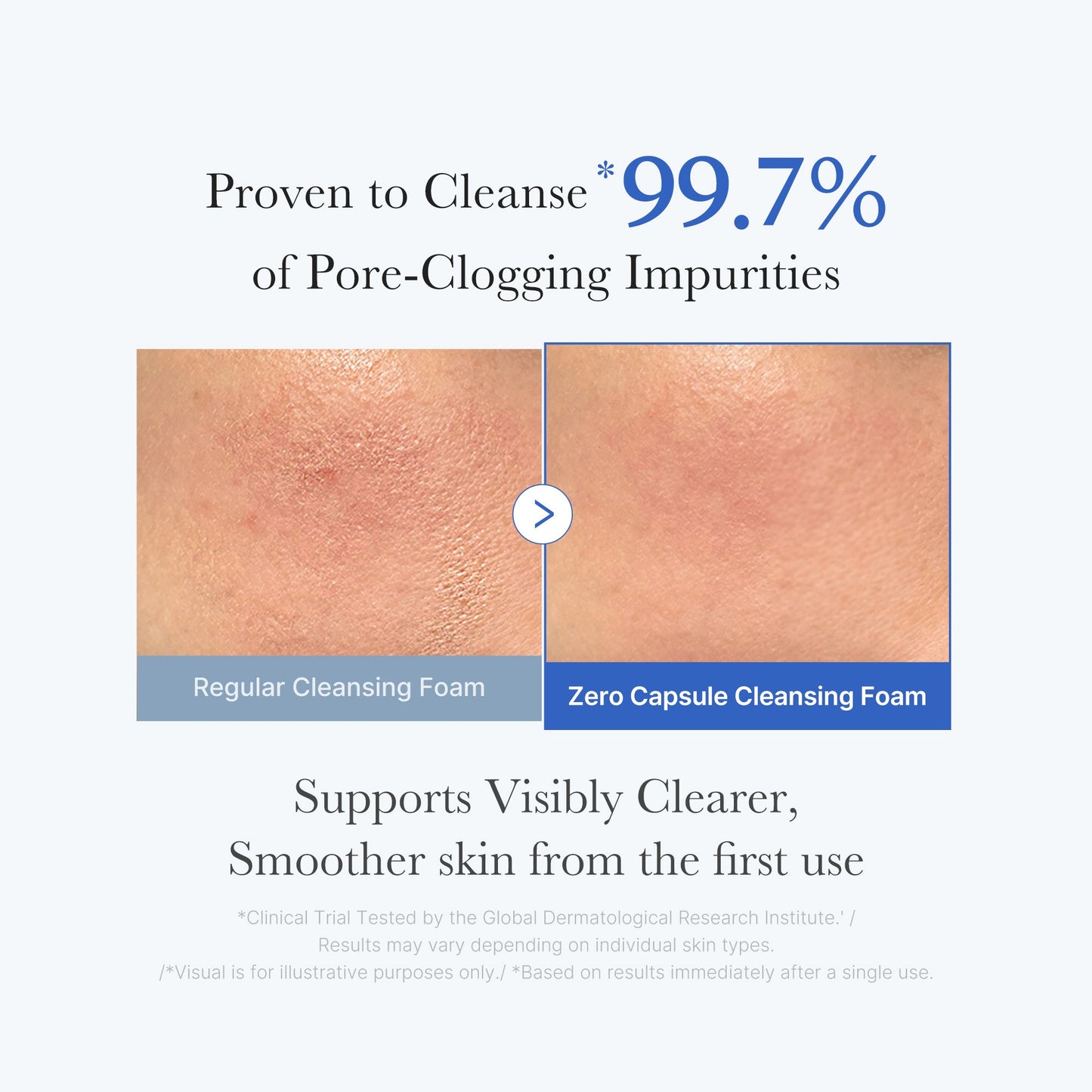zero-pore-capsule-cleansing-foam-o7 02_c1fb9dfb-86c5-4038-8ff8-490d1006276c.jpg