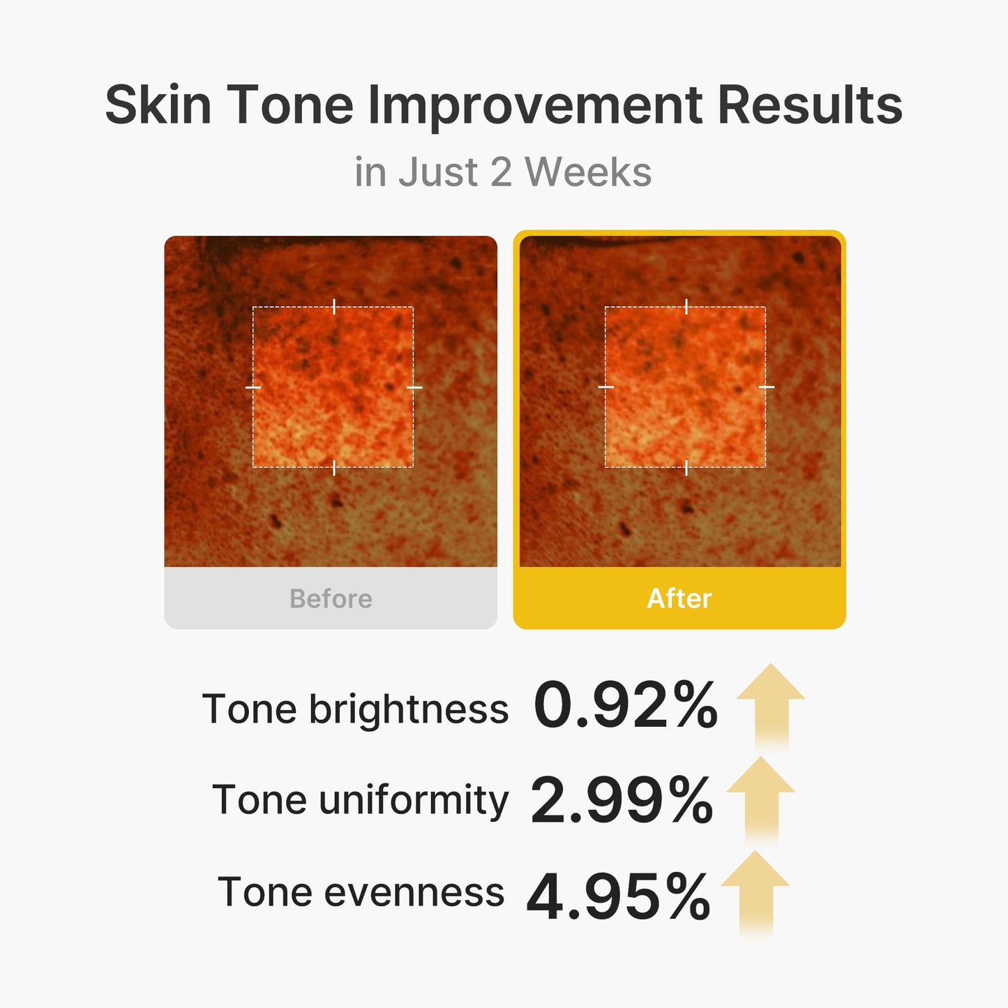 kojic-acid-turmeric-vita-capsule-cream-e1 03_2b626701-fc6c-4702-9e96-a2157a4f7f9d.jpg