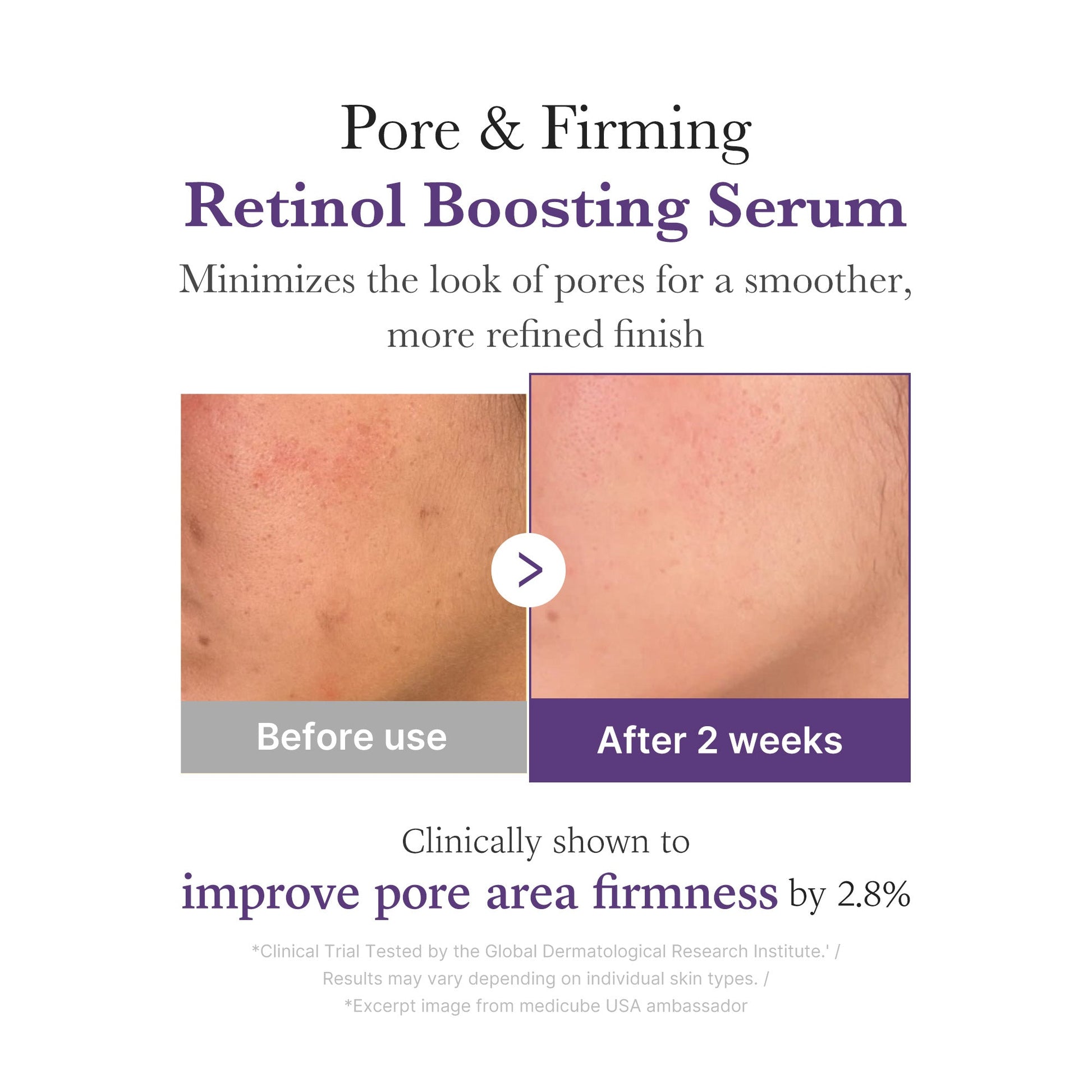 retinol-nmn-boosting-serum-z1 03_3510e7a5-5633-4a18-81ea-1389593bd517.jpg