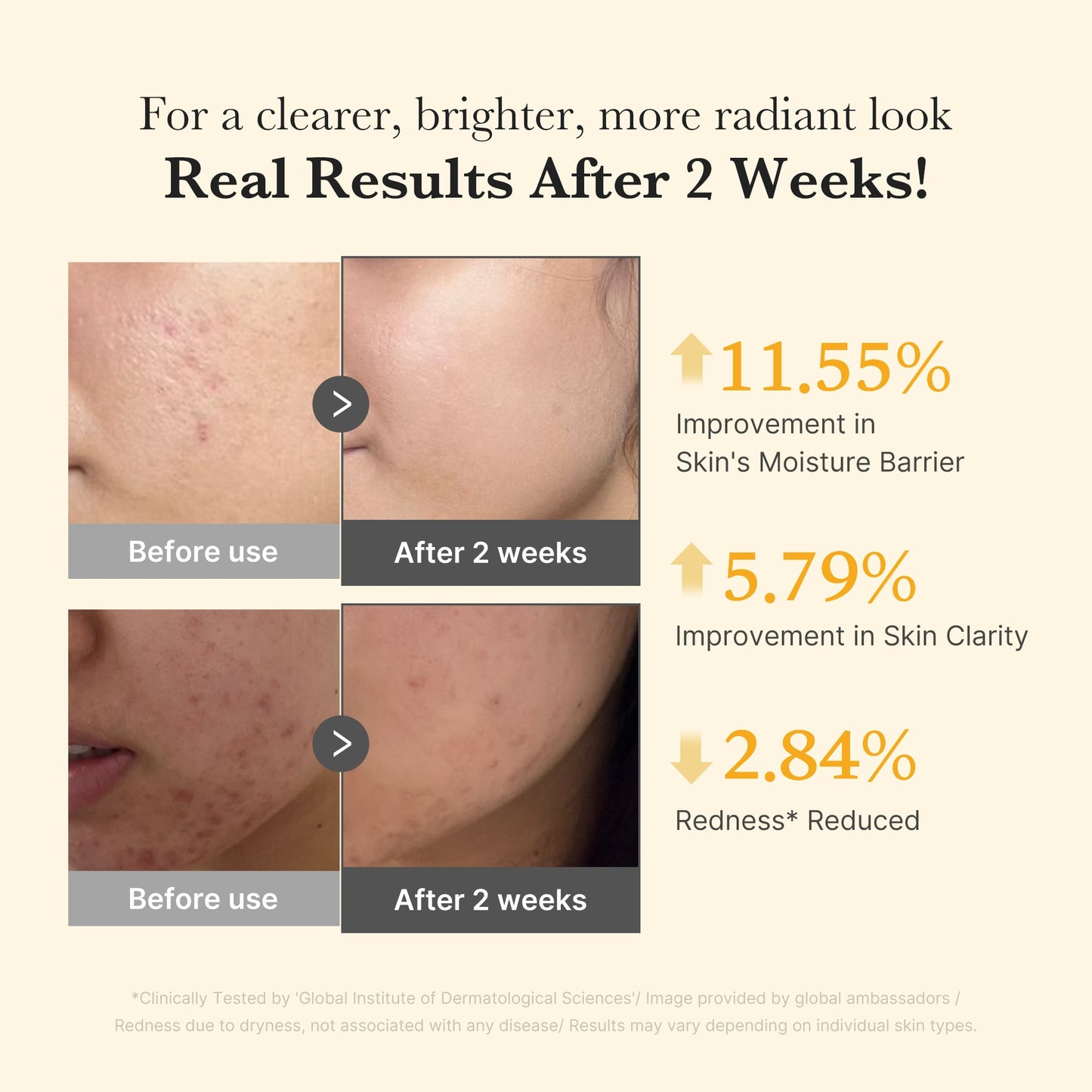 kojic-acid-turmeric-capsule-serum-q1 03_436487f5-76df-490e-8a61-01118373efbd.jpg
