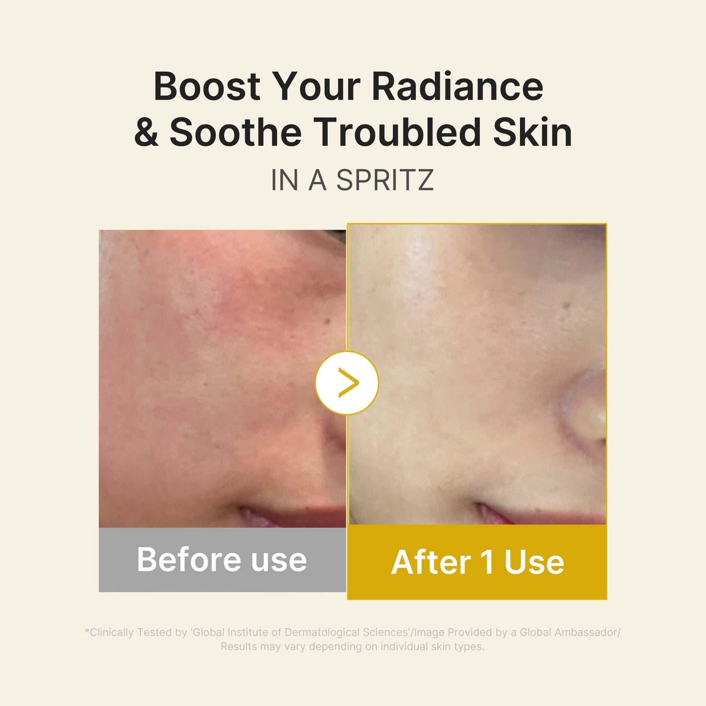 kojic-acid-turmeric-vitamin-gold-jelly-mist-serum-t0 03_dc9cd19e-4e57-49d3-9b66-c7762e8a63f1.jpg