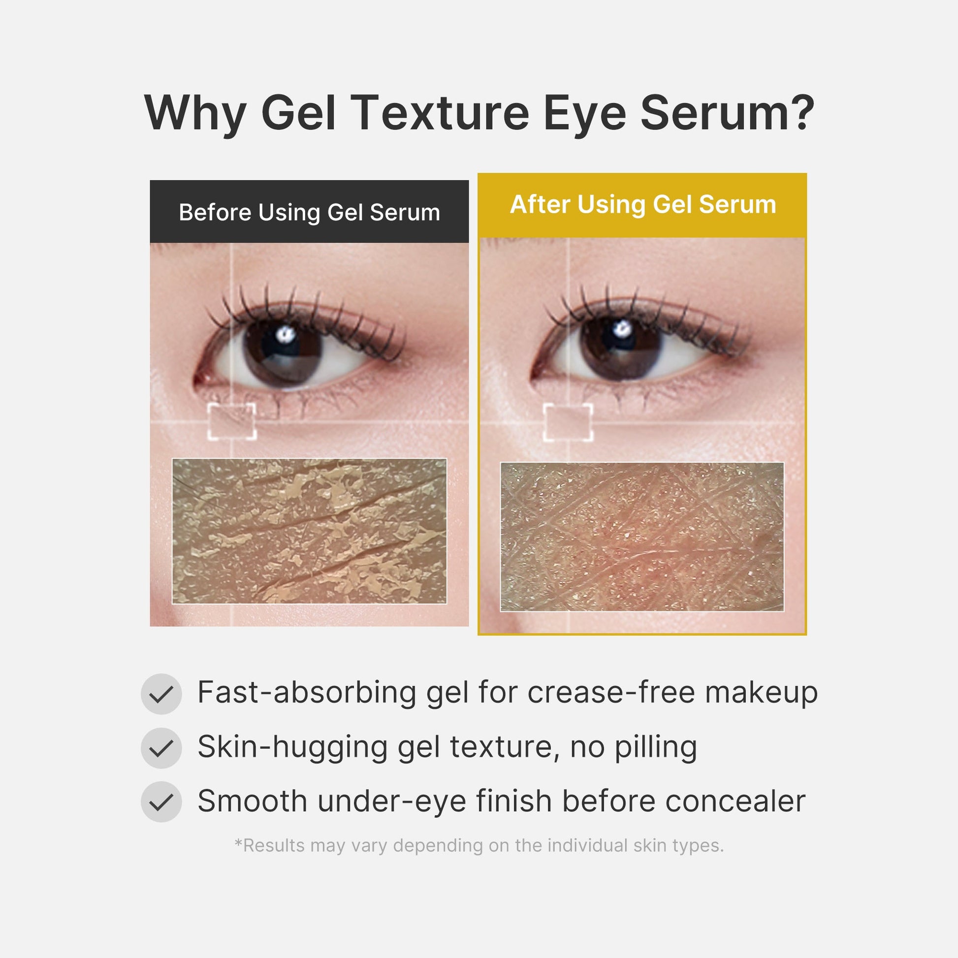 kojic-acid-tumeric-eye-gel-serum-e9 04_0487ef36-49f4-4294-8049-bb55118b05fe.jpg