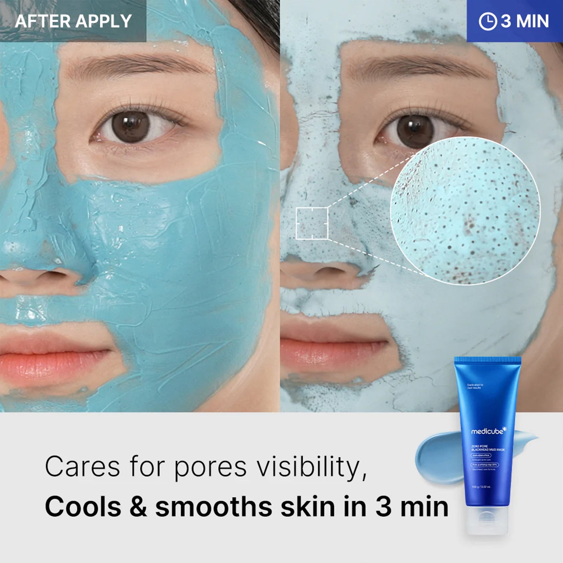 zero-pore-blackhead-mud-mask-e9 04_867c0459-a94e-40d3-bd9a-70400edabe8d.jpg