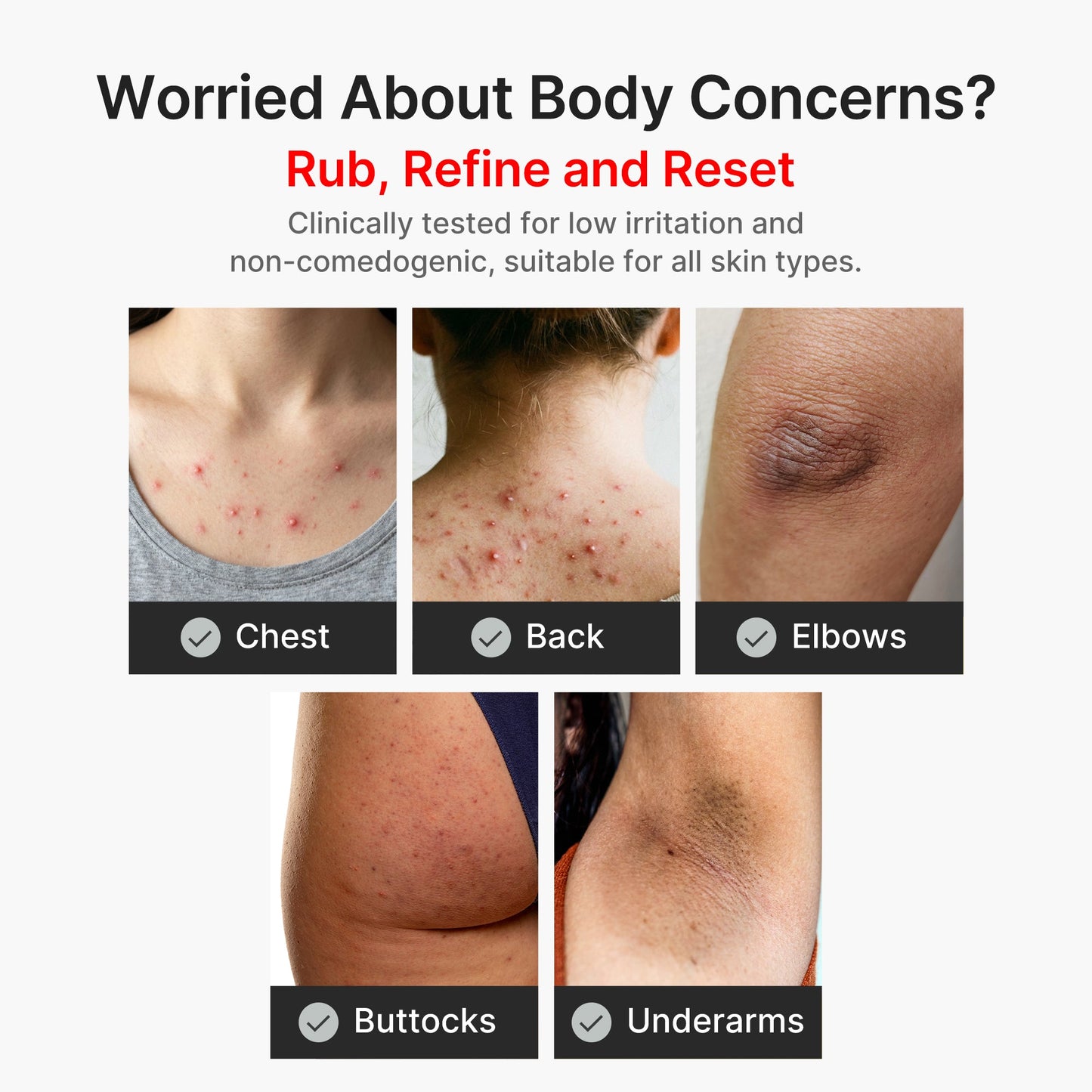 kojic-acid-turmeric-body-peel-shot-d8 04_8a7237f2-3ebf-401e-bd85-54841aeb3efc.jpg