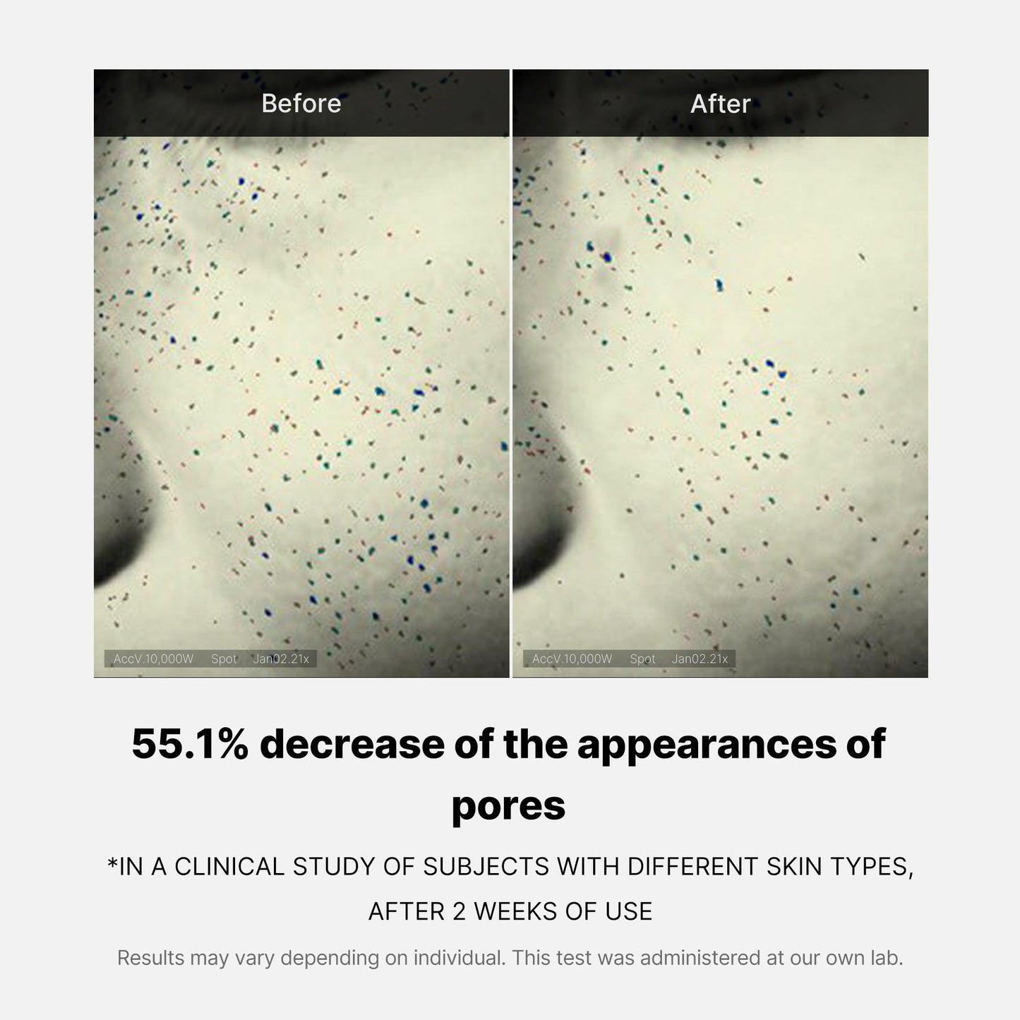 pore-care-duo-j4 05_12ddab8a-64be-4612-8ee1-27e5ec701921.jpg