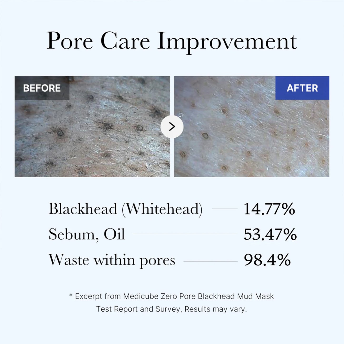 zero-pore-blackhead-mud-mask-e9 05_9362a158-c2b3-4525-acc0-631a2cfdea47.jpg
