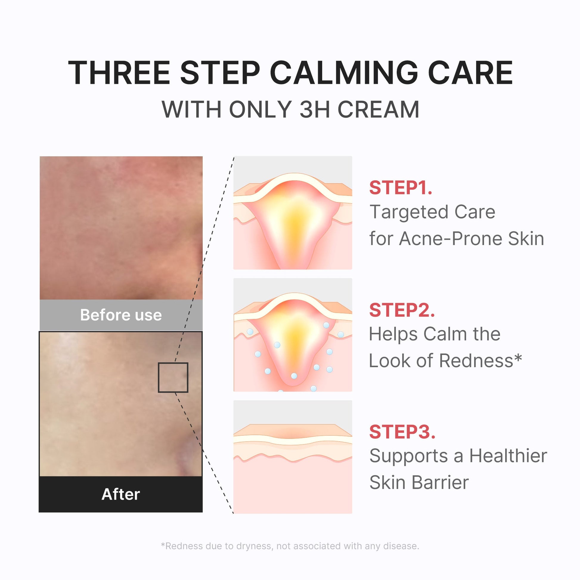 3h-daily-relief-cream-d3 3H_04.jpg