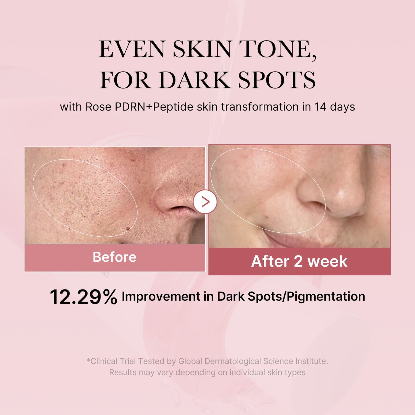 pdrn-pink-peptide-toner-r8 PDRN_01_308c518e-5ac6-4e54-99bd-eabc8796739b.jpg