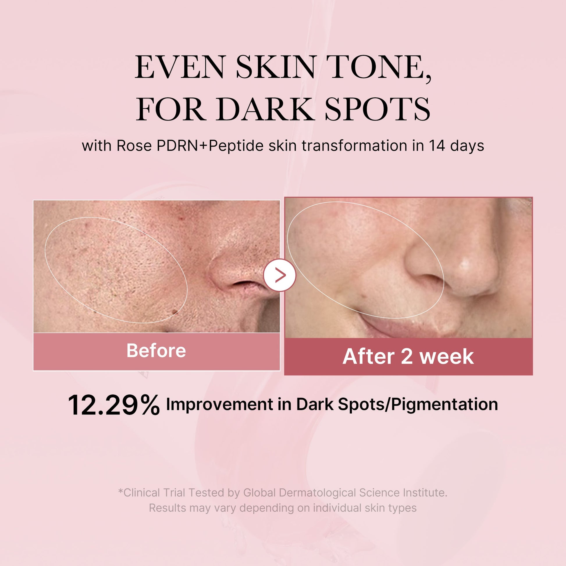 pdrn-pink-peptide-toner-r8 PDRN_01_308c518e-5ac6-4e54-99bd-eabc8796739b.jpg