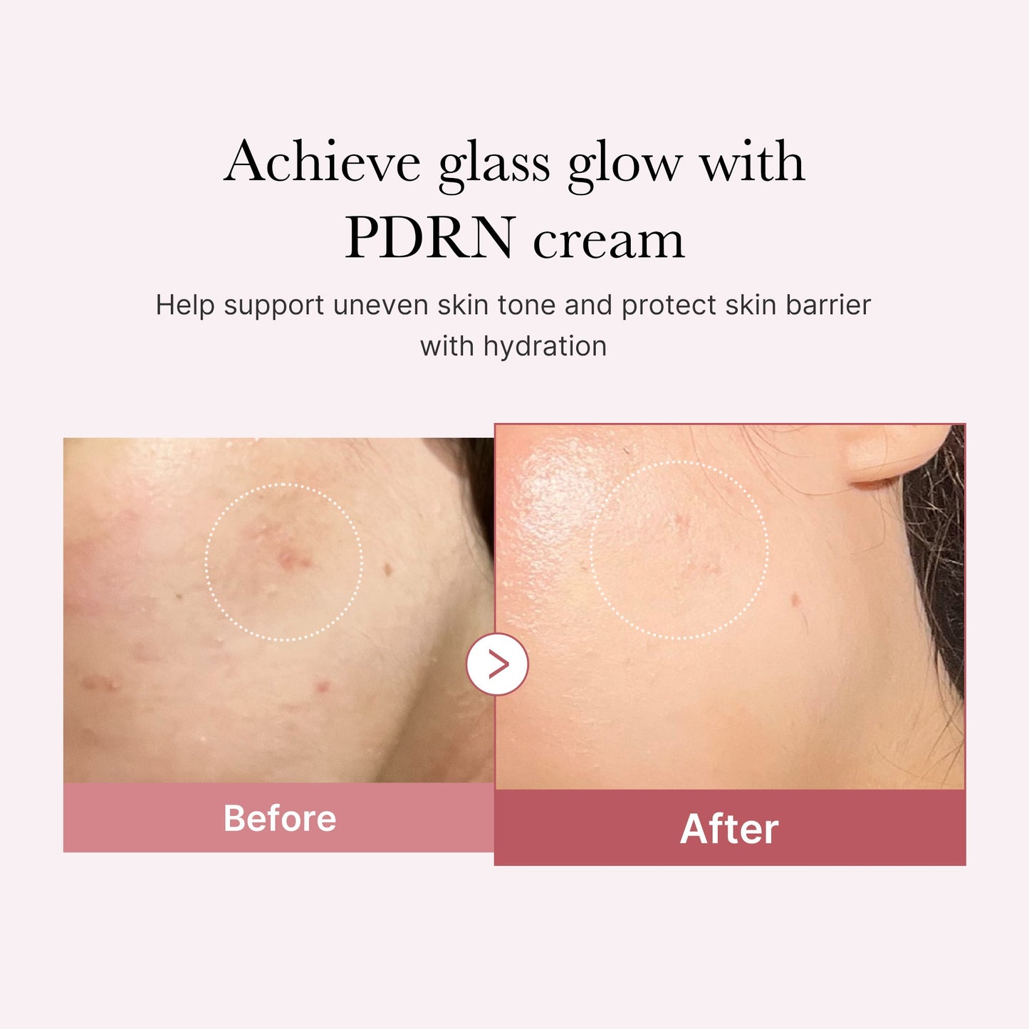 pdrn-pink-peptide-cream-z2 PDRN_02_d7805bfe-cf43-446a-b71b-a276683f136b.jpg