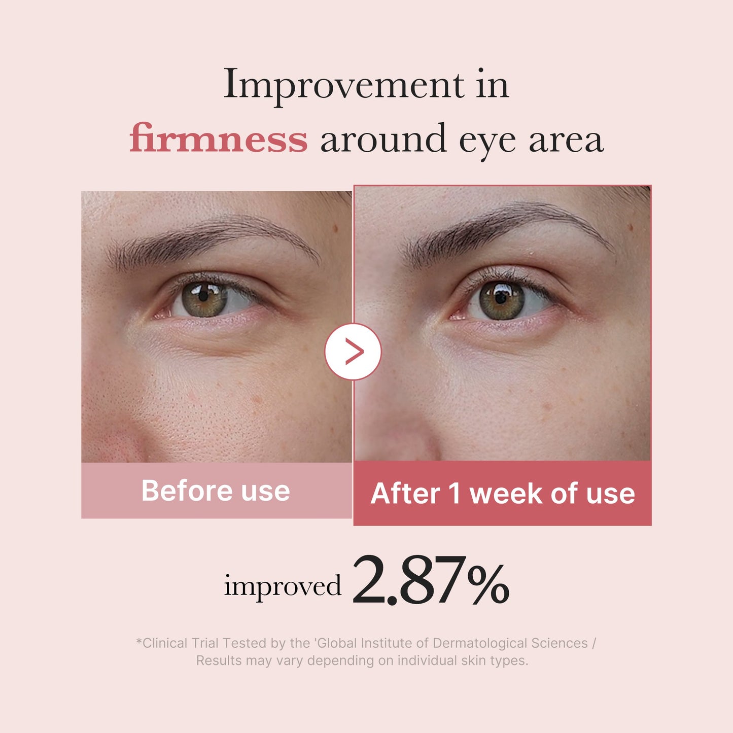 pdrn-pink-peptide-eye-cream-w6 PDRN_03_256dd753-0a2f-41b4-b3cd-bbfd3bc27018.jpg