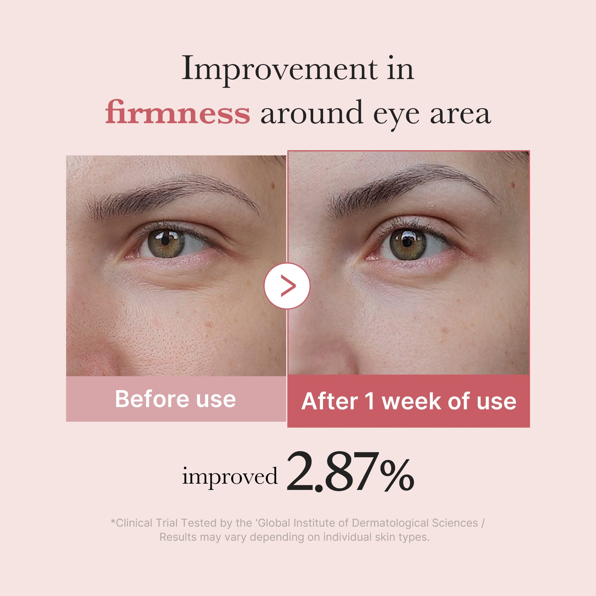 pdrn-pink-peptide-eye-cream-w6 PDRN_03_256dd753-0a2f-41b4-b3cd-bbfd3bc27018.jpg