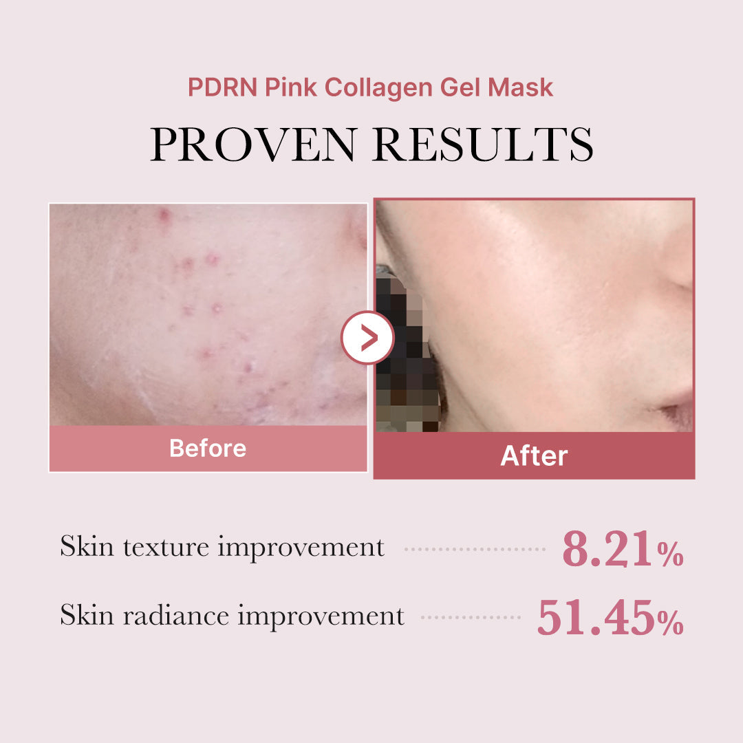 salmon-pdrn-pink-collagen-jelly-gel-mask-w6 PDRN_12.jpg