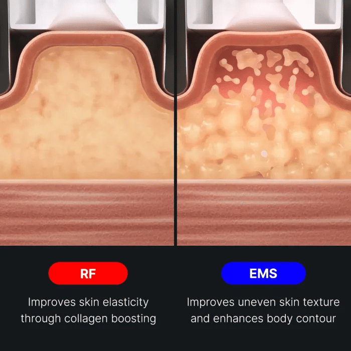 age-r-contour-body-shot-e7 img.webp